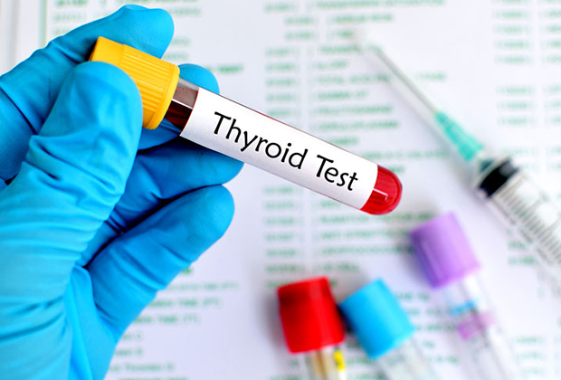 Thyroid Test in Dombivli
